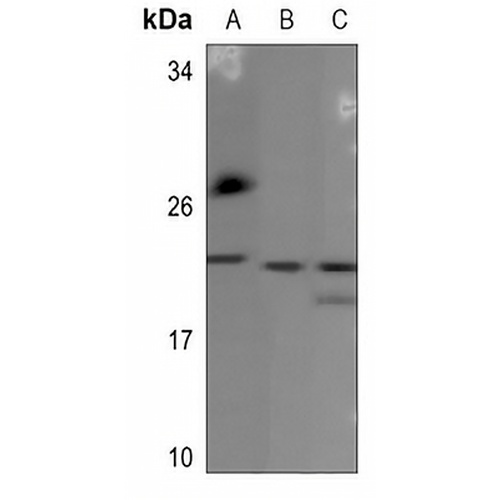 BCA3 Rabbit Polyclonal Antibody