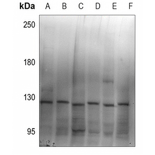 ZC3H7B Rabbit Polyclonal Antibody