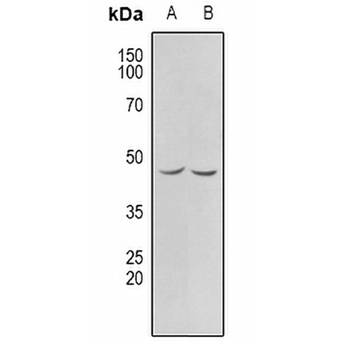 CHKB Rabbit Polyclonal Antibody