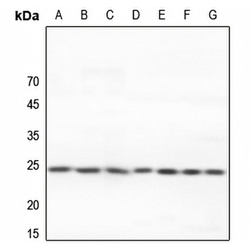 Adenylate Kinase 6 Rabbit Polyclonal Antibody