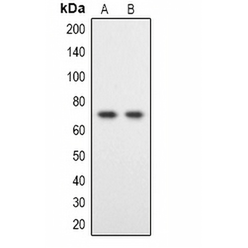 DYRK1B Rabbit Polyclonal Antibody