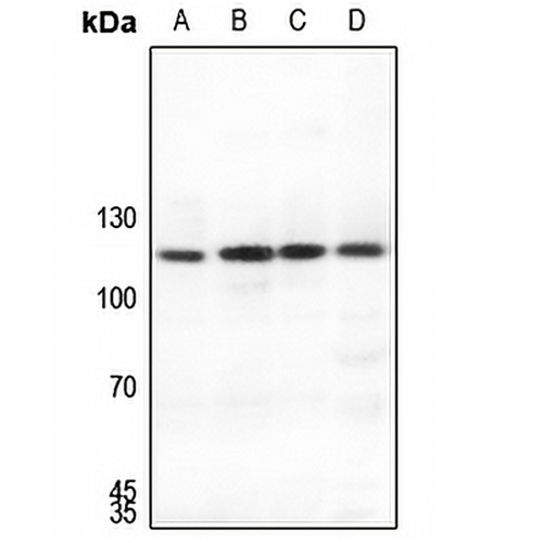 SUPT16H Rabbit Polyclonal Antibody