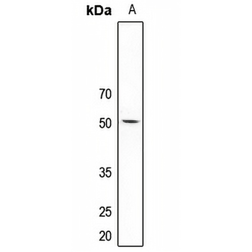 5-HT2C Rabbit Polyclonal Antibody