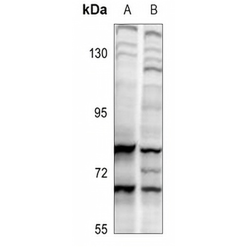 CDC6 Rabbit Polyclonal Antibody