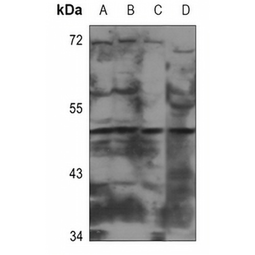 CADM2 Rabbit Polyclonal Antibody
