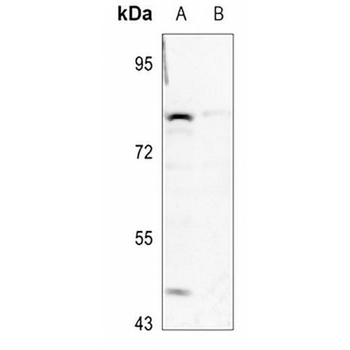 GSPT1 Rabbit Polyclonal Antibody