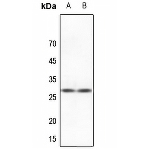 HSPB2 Rabbit Polyclonal Antibody