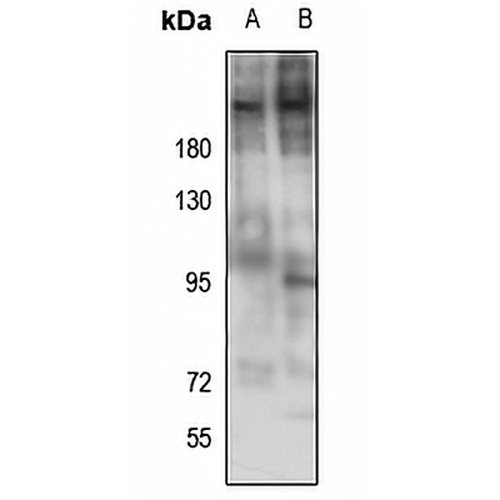 Laminin beta 2 Rabbit Polyclonal Antibody