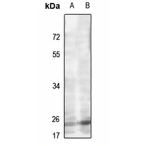 MRPL22 Rabbit Polyclonal Antibody