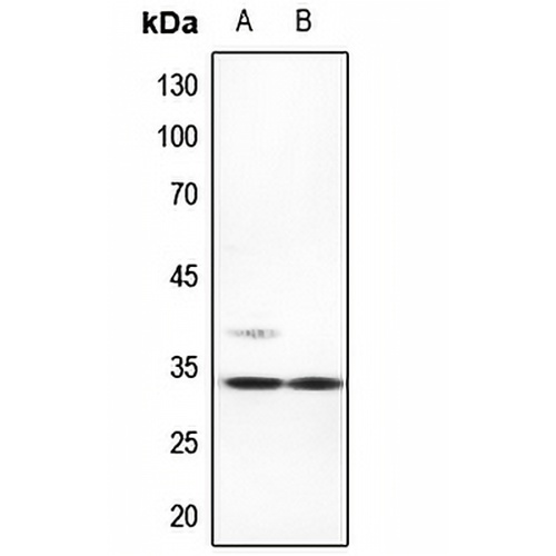 ACBD6 Rabbit Polyclonal Antibody