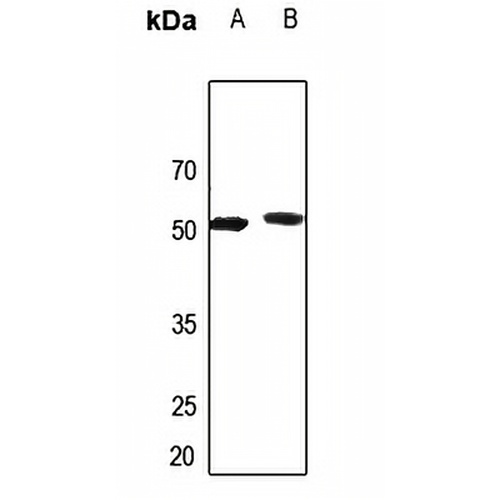 AGXT2L2 Rabbit Polyclonal Antibody