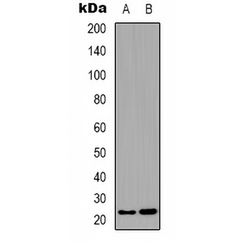 BCAS4 Rabbit Polyclonal Antibody