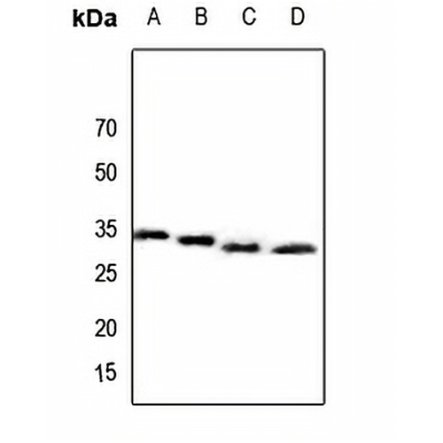 CBR3 Rabbit Polyclonal Antibody