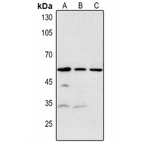 RRP8 Rabbit Polyclonal Antibody