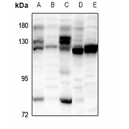 POLR3B Rabbit Polyclonal Antibody