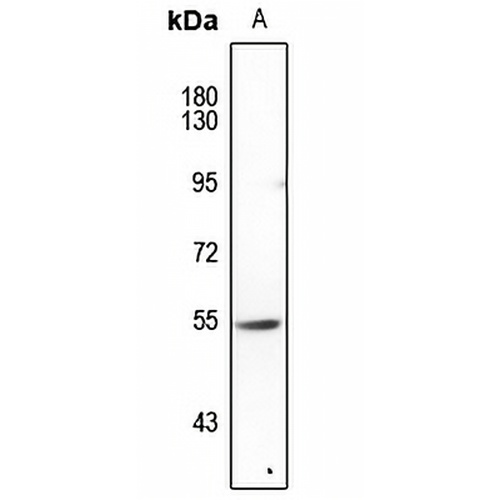 FOXN4 Rabbit Polyclonal Antibody