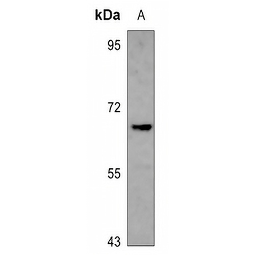 NXF3 Rabbit Polyclonal Antibody
