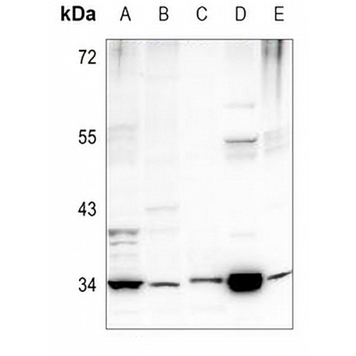 PEX2 Rabbit Polyclonal Antibody