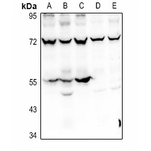 Prosaposin Rabbit Polyclonal Antibody