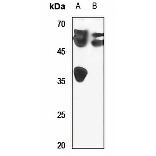 LUC7L2 Rabbit Polyclonal Antibody