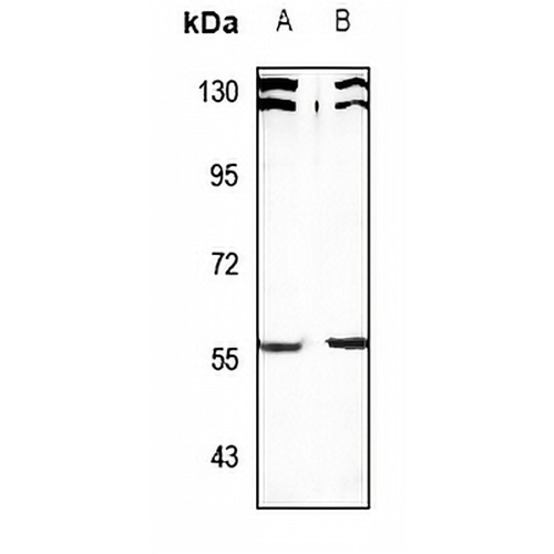 SESN1 Rabbit Polyclonal Antibody