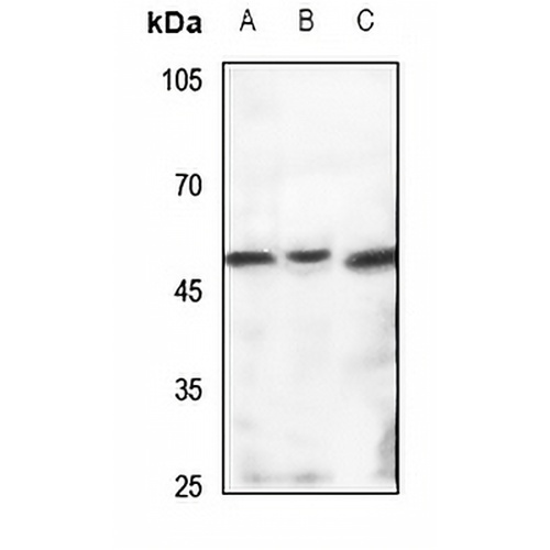 TBL2 Rabbit Polyclonal Antibody