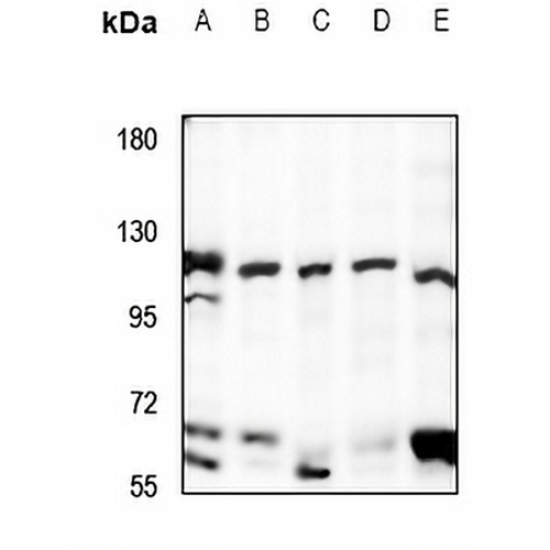 UBE3B Rabbit Polyclonal Antibody