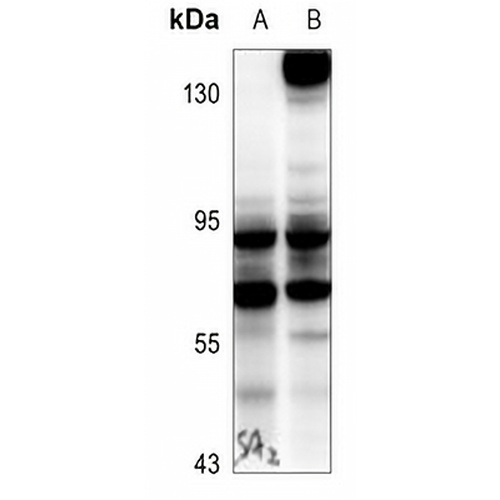 BAG3 Rabbit Polyclonal Antibody