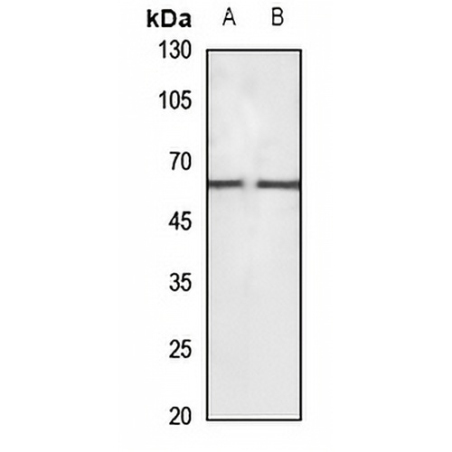 CaMKK beta Rabbit Polyclonal Antibody