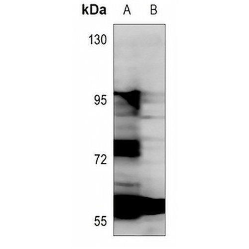 ANGPTL1 Rabbit Polyclonal Antibody