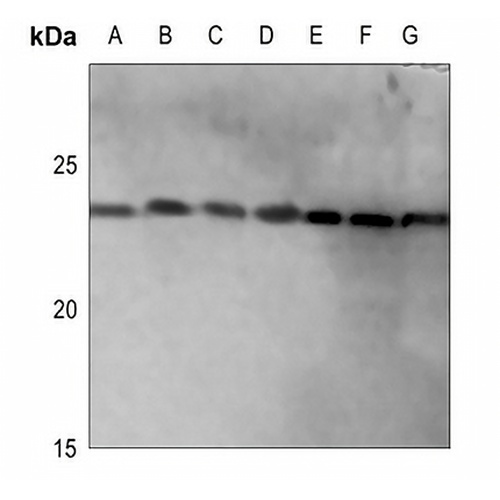 IFN alpha 1 Rabbit Polyclonal Antibody