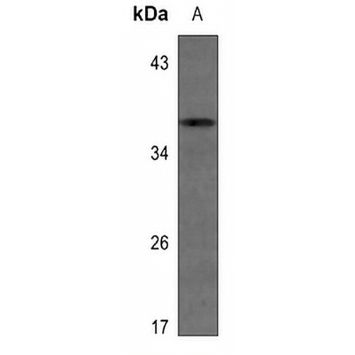 IGFBP1 Rabbit Polyclonal Antibody