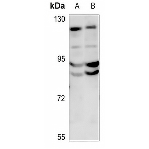 DPD Rabbit Polyclonal Antibody