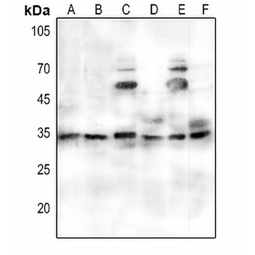 PORIN Rabbit Polyclonal Antibody