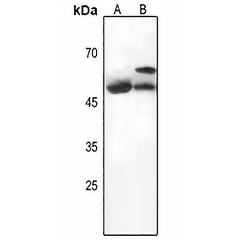 Serpin A3 Rabbit Polyclonal Antibody