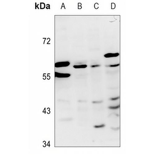 ZNF384 Rabbit Polyclonal Antibody