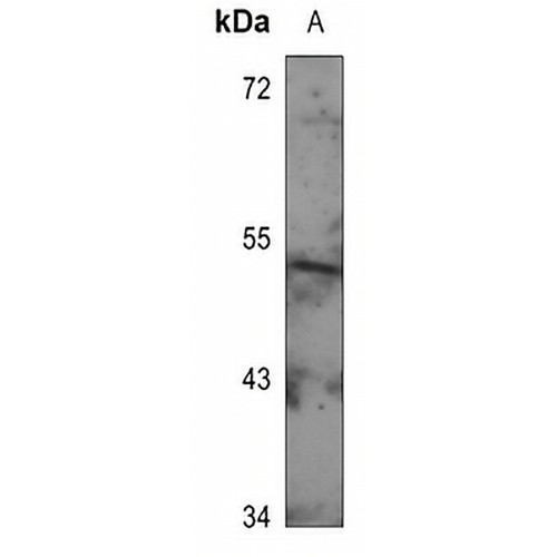 GIP Receptor Rabbit Polyclonal Antibody