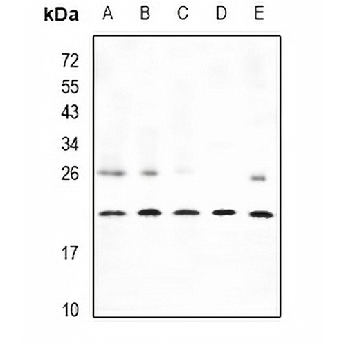 CPI17 Rabbit Polyclonal Antibody