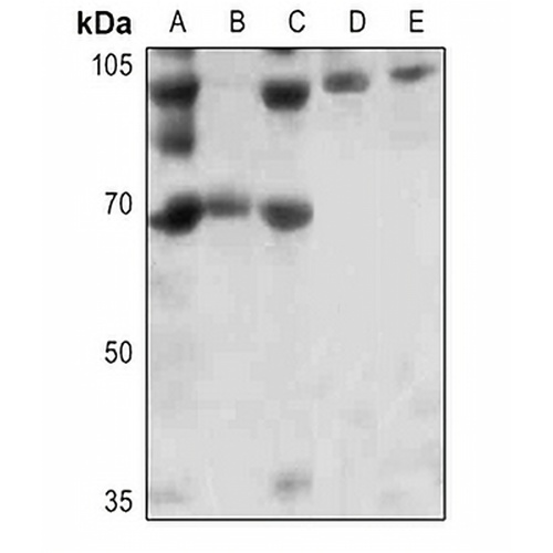 FOXO1 (Phospho-S256) Rabbit Polyclonal Antibody
