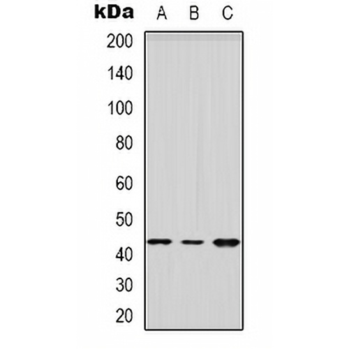 HSD3B2 Rabbit Polyclonal Antibody