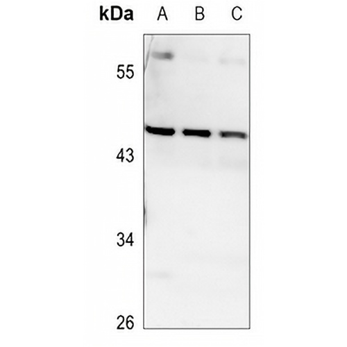 VPS4B Rabbit Polyclonal Antibody