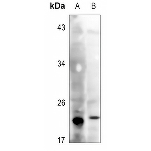 Glutathione Peroxidase Rabbit Polyclonal Antibody