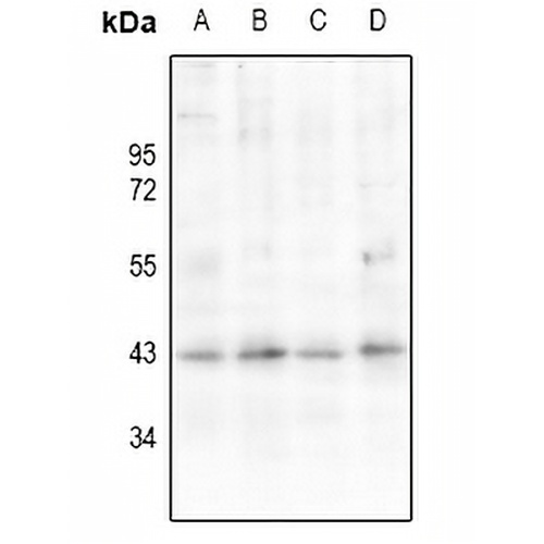 AT1 Rabbit Polyclonal Antibody