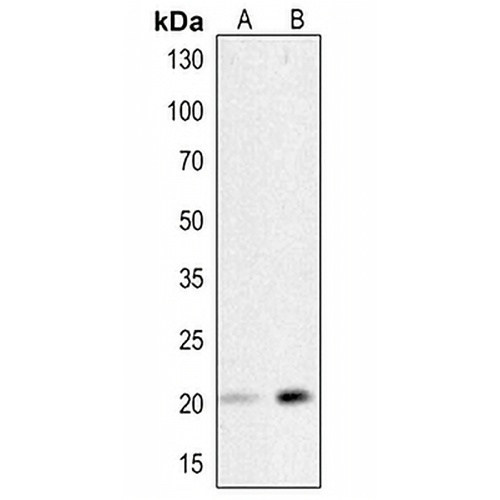 HSP20 (Phospho-S16) Rabbit Polyclonal Antibody