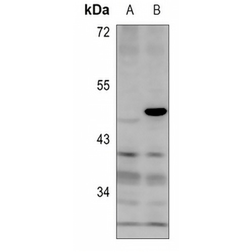 MKI67IP (Phospho-T234) Rabbit Polyclonal Antibody
