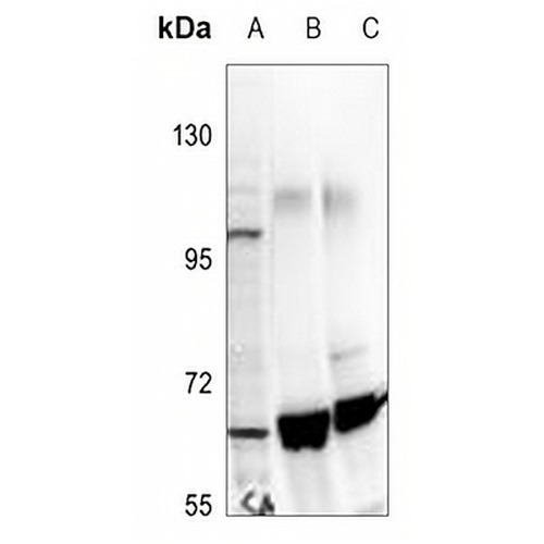 TIP60 Rabbit Polyclonal Antibody