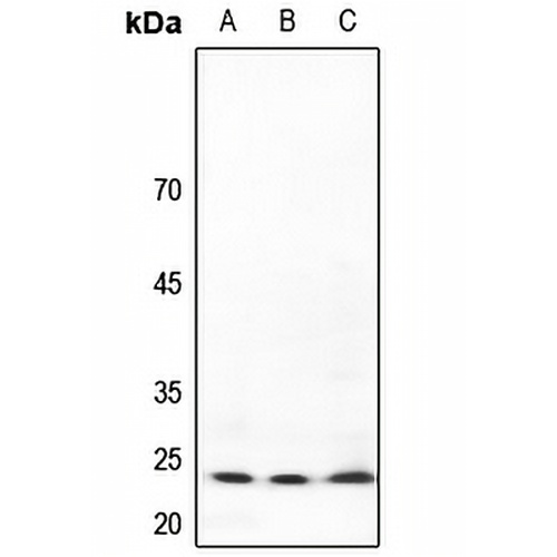 TP53INP2 Rabbit Polyclonal Antibody