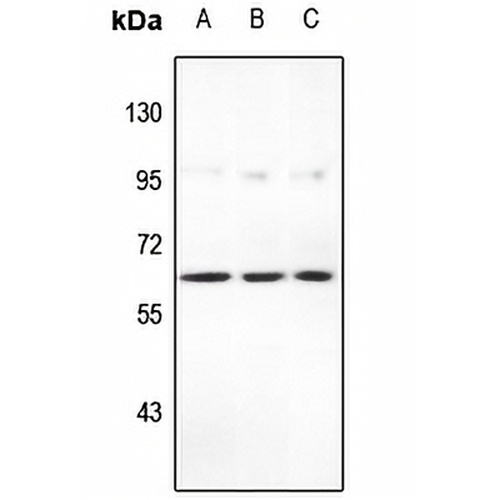 STEAP2 Rabbit Polyclonal Antibody