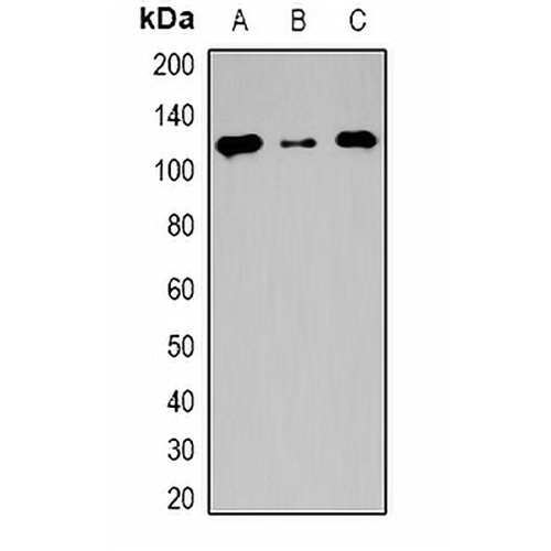 TSHZ2 Rabbit Polyclonal Antibody