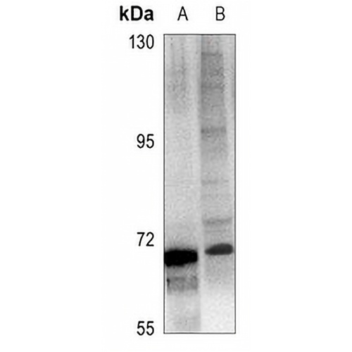 ICK Rabbit Polyclonal Antibody